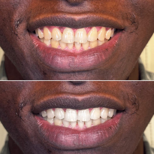 Dentex™ — Dentifrice Éclat & Blancheur